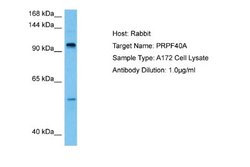 FNBP3 Antibody, Novus Biologicals 100 &mu;L; Unconjugated:Antibodies, Polyclonal